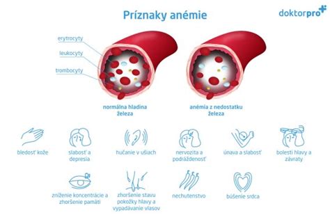 Ako zvýšiť hladinu železa v krvi prirodzene