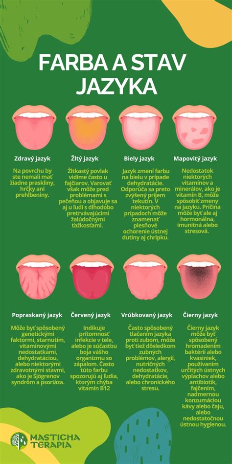 Biely povlak na jazyku