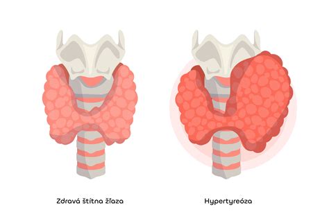 Chlorella a štítna žľaza