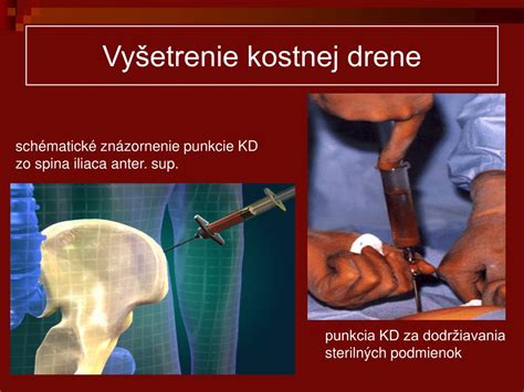 Funkcie kostnej drene