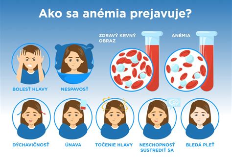 Infografika - Anémia