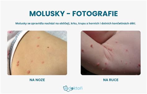 Molusky