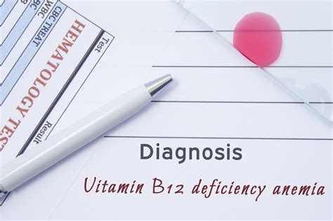 Nedostatok vitamínu B12 - príznaky