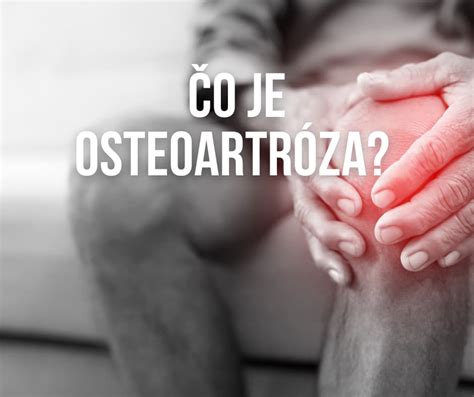 Osteoartróza kĺbov