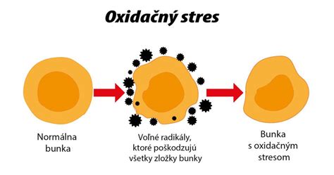 Oxidačný stres