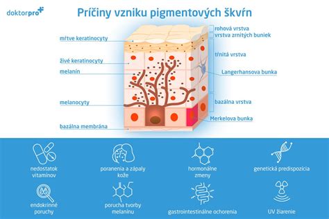 Príčiny vzniku artrózy