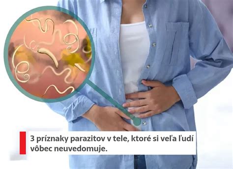 Príznaky parazitov v tele