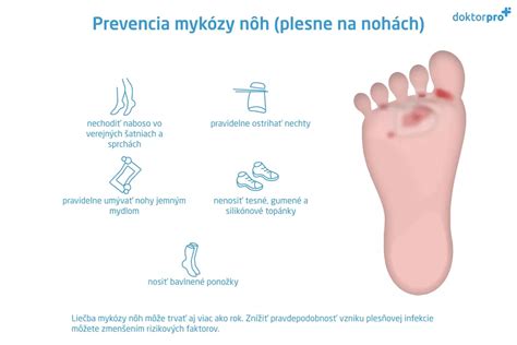 Prevencia studených nôh