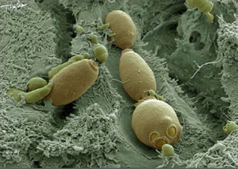 Saccharomyces Boulardii