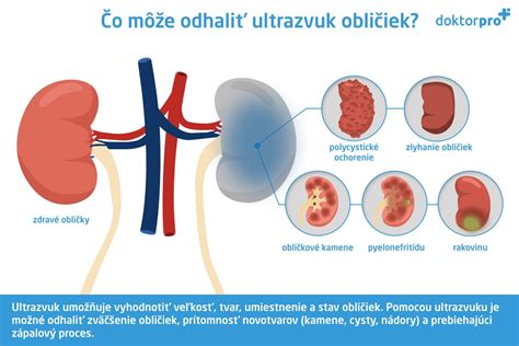 Zdravé obličky